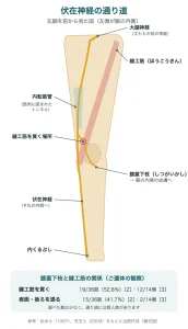 伏在神経の通り道（内転筋管、縫工筋を貫く膝蓋下枝、すねの内側へ向かう枝）の模式図