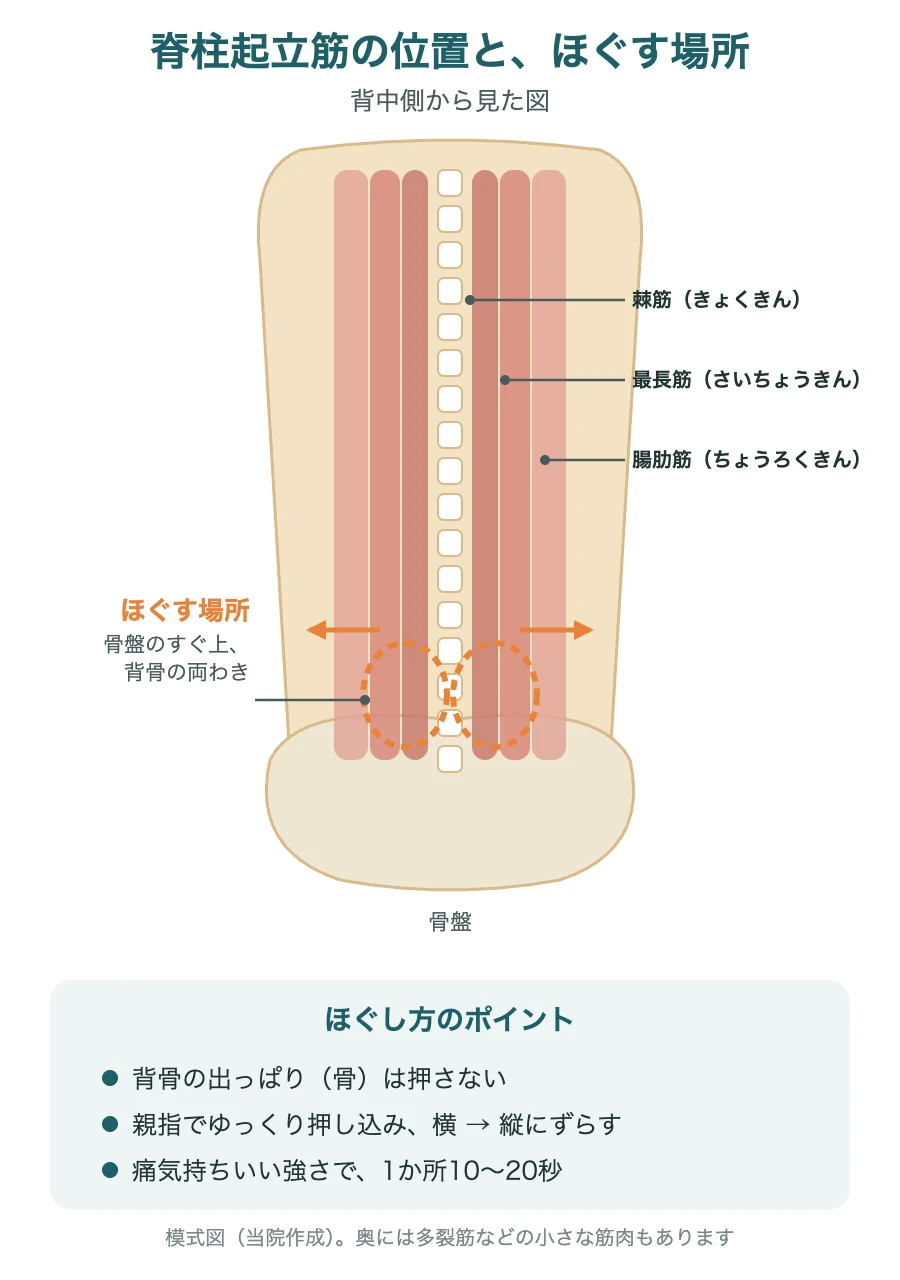 脊柱起立筋（棘筋・最長筋・腸肋筋）の位置と、骨盤のすぐ上のほぐす場所の模式図